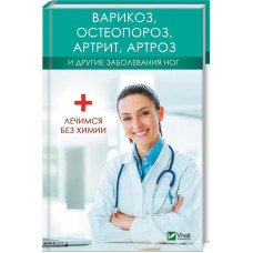 Варикоз остеопороз артрит артроз и другие заболевания ног Лечимся без химии